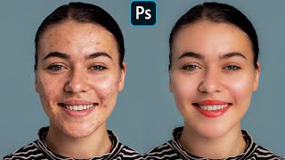 Face Retouching  Best Photoshop Tutorial  Skin Retouching [upl. by Atirec435]