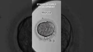 Early development of human  Cleavage  morula  blastulation [upl. by Namaan538]