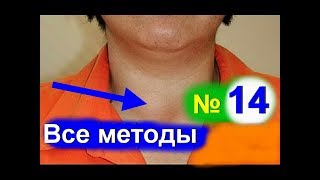 Крупный узел УЗИ Цитологическое исследование и Сцинтиграфия узла щитовидной железы [upl. by Giorgio]