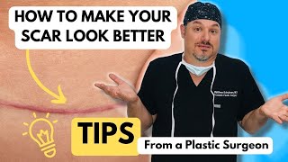 Tips for Treating Scars [upl. by Doscher]