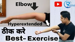 hyperextended elbow treatmentkohni ka tirchapan kaise thik kareelbow deformity elbows elbowpain [upl. by Fulbert196]