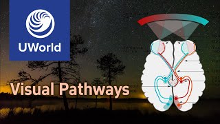 Visual PathwaysOptic Nerve PathwayVision  USMLE Step 1 UWorld Questions MBBS Ophthalmology [upl. by Leonidas501]