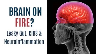 Is your brain on FIRE Neuroinflammation Leaky Gut and CIRS [upl. by Ettenna]