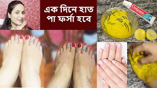 এক দিনে হাত পা দুধের মত ফর্সা উজ্জ্বল হবেFeet Whitening PedicureCracked heel treatmentGlowingskin [upl. by Leggett190]