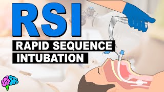 What is Rapid Sequence Intubation RSI [upl. by Assiram]