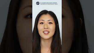 A Patients Journey with Dr Kenneth Kim  Double Eyelid amp Ptosis Surgery Testimonial💫✨ [upl. by Ainezey633]