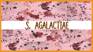 Streptococcus Agalactiae [upl. by Diarmid]