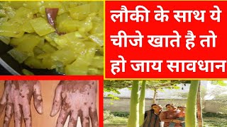 लौकी के साथ ये चीजे खाते है तो हो जाय सावधानkrishisamvaad worng food combination [upl. by Falito]