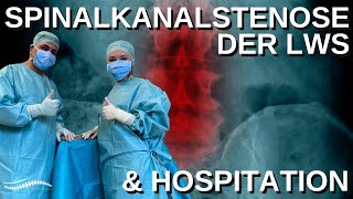 Spinalkanalstenose der LWS amp Hospitation rückenschmerzwirbelsäulespinalkanalstenoseoperation [upl. by Notnerb147]