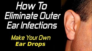 How does Otic Solution ear drops work to remove water and earwax [upl. by Fraya]