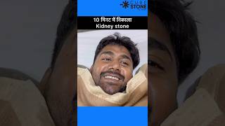 Kidney stone treatment  Retrograde Intrarenal Surgery  FANS RIRS shortsviral [upl. by Dew]