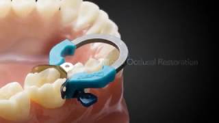 Palodent V3 I Dentsply Sirona [upl. by Lemhar63]