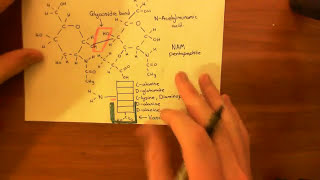 Vancomycin Resistant Enterococcus Part 3 [upl. by Aryn]