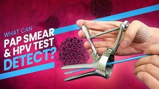 Pap Smear Pap Test and HPV Test  A step by step guide 3D at what happens during the test [upl. by Trout896]