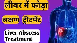 liver abscess treatment in hindi  Liver Abscess in hindi [upl. by Katonah792]