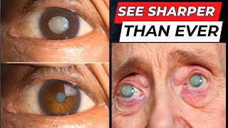 See Sharper Than Ever 👁 10 Superfoods to Supercharge Your Eye Health [upl. by Harak]