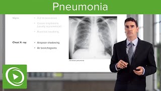 Pneumonia Types Classification Symptoms amp Management  Respiratory Medicine [upl. by Imot521]