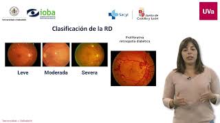 Programa de cribado de retinopatía diabética [upl. by Evin]