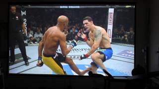 Anderson Silva vs Chris Weidman Leg Break Official Video [upl. by Anitteb]