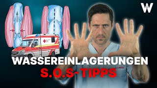 Wassereinlagerungen in Händen amp Füßen Ursachen und Tipps bei angeschwollenen Armen amp Beinen Ödeme [upl. by Amann]