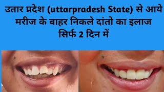 Uttarpradesh State उत्तर प्रदेश गोरखपुर से आये मरीजों का हुआ दांतों का इलाज सिर्फ 2 दिन में smile [upl. by Accem]