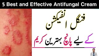 Best fungal Infection Cream Urdu Hindi fungal infection cream without steroids  Ringworm Cream [upl. by Naillij]