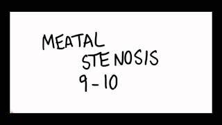 MEATAL STENOSIS Practice Video 1 [upl. by Oileduab516]