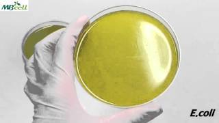 Bacillus Cereus Agar [upl. by Derreg]