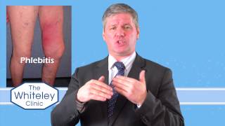 Phlebitis  What is phlebitis and how should phlebitis be treated [upl. by Sue837]