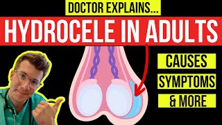 What is a HYDROCELE Doctor explains causes symptoms and treatment including surgery [upl. by Valera]