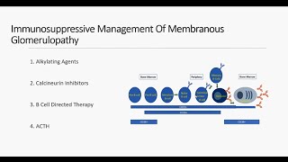 Membranous Nephropathy  An Evidence Based Approach to Treatment [upl. by Oilerua]