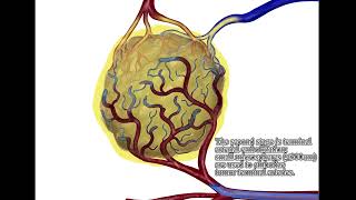 Transarterial Chemoembolization for HCC  Supplementary video ID 433409 [upl. by Aerdnod251]