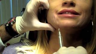 Cannula Method for Fillers  Dr Nissan Pilest Irvine CA [upl. by Robina911]