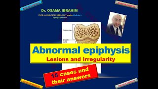 Abnormal epiphysis 15 cases with their answers [upl. by Raquela]