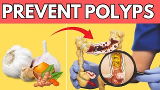 Top 9 Miracle Foods to Prevent Polyps and Colon Cancer [upl. by Asilef445]