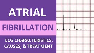 Atrial Fibrillation AFib ECG Treatment Causes Nursing NCLEX Review ACLS [upl. by Jessen417]