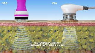 Cavitation 30 VS Cavitation 20 What is the difference Between Cavitation 30 and Cavitation 20 [upl. by Roots]