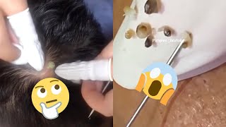 Ultimate Pimple Popping Compilation Prepare to Be Amazed [upl. by Natalia]