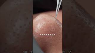 Do a treatment to clean it up Immersive Skin Care Blackhead Strawberry Nose DeepPore Cleansing [upl. by Havot]