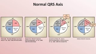 Intro to EKG Interpretation  Rate and Axis [upl. by Sanborne]