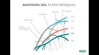 Lesion plexo braquial  raíces C5C6C7 [upl. by Gabbie]