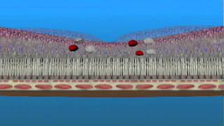 Macular Edema and Ischemia [upl. by Assirram238]