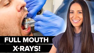 Dental Hygienist Explains Full Mouth Dental XRay FMX [upl. by Oys]