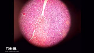 Lymphatic Systems Histology Slide Preview  Microscopic View  Anatomy [upl. by Atteuqaj]