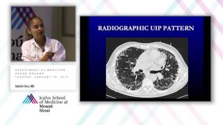 Idiopathic Pulmonary Fibrosis New Hope for an Old Disease [upl. by Yevad999]