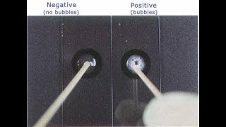 Catalase Test  How to perform [upl. by Ariahaj]