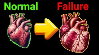 5 Early signs of Heart Failure  Congestive Heart Failure [upl. by Ima]