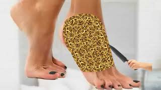 ASMR Foot Worm Removal  Maggot Extraction Animation Therapy  프리미어12  プレミア12 TalesOfTingles [upl. by Ailey]