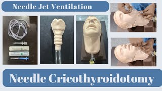 How to do Needle Cricothyroidotomy  Needle Jet Ventilation [upl. by Nobe490]