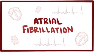 Atrial fibrillation Afib AF  causes symptoms treatment amp pathology [upl. by Pas]